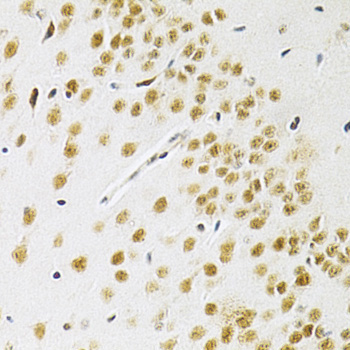 BAF57/SMARCE1 Rabbit Polyclonal Antibody - Image 3