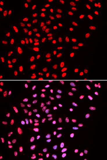 BAF57/SMARCE1 Rabbit Polyclonal Antibody - Image 4