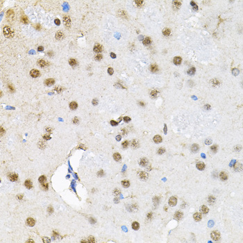 BAF60a Rabbit Polyclonal Antibody - Image 2