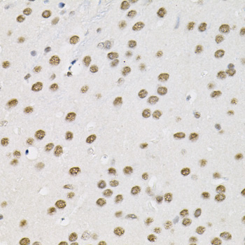 BAF60a Rabbit Polyclonal Antibody - Image 4