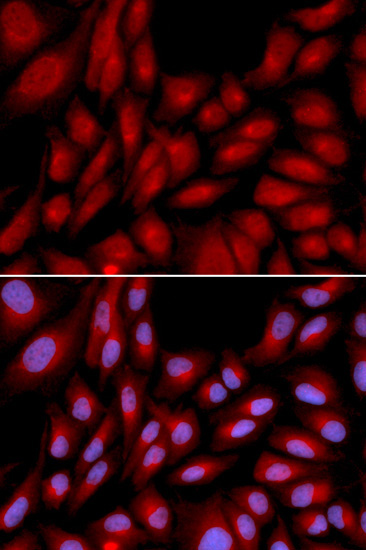 BAG1 Rabbit Polyclonal Antibody - Image 2