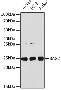 BAG2 Rabbit Monoclonal Antibody