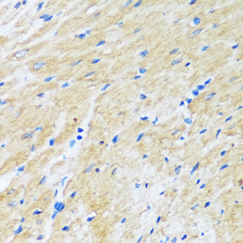 BAG3 Rabbit Polyclonal Antibody - Image 2