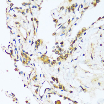 BAG3 Rabbit Polyclonal Antibody - Image 3