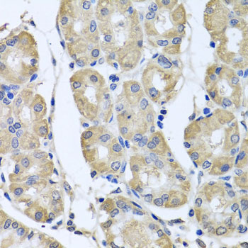 BAG5 Rabbit Polyclonal Antibody - Image 2