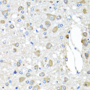 BAG5 Rabbit Polyclonal Antibody - Image 3