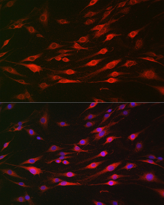 Bak Rabbit Polyclonal Antibody - Image 2