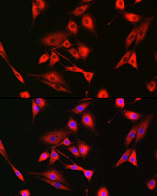 Bak Rabbit Polyclonal Antibody - Image 3