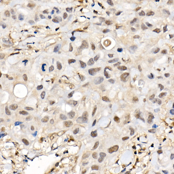 BAP1 Rabbit Polyclonal Antibody - Image 2