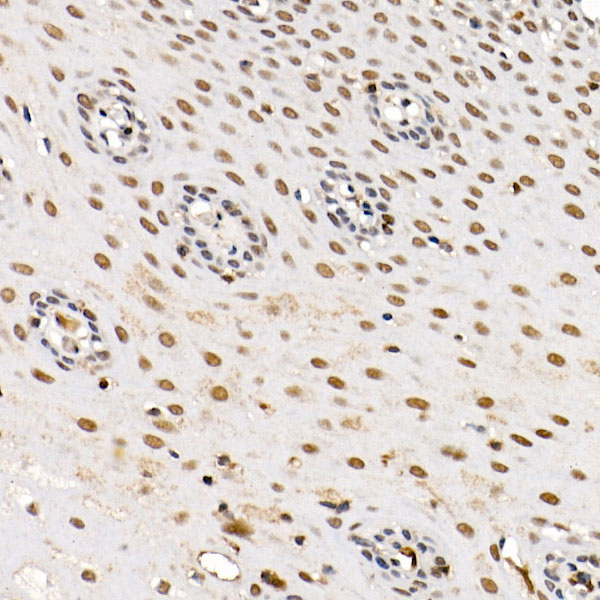 BAP1 Rabbit Polyclonal Antibody - Image 3