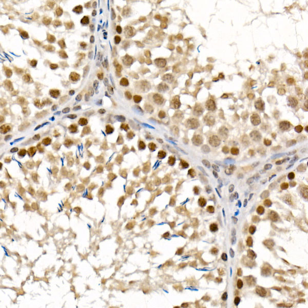 BAP1 Rabbit Polyclonal Antibody - Image 4