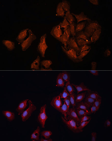 BAP1 Rabbit Polyclonal Antibody - Image 5