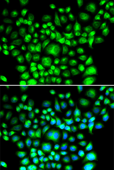 BAP31 Rabbit Polyclonal Antibody - Image 2