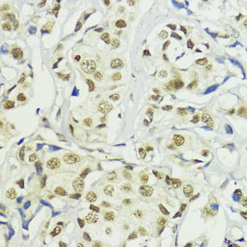 BAZ2A Rabbit Polyclonal Antibody - Image 2