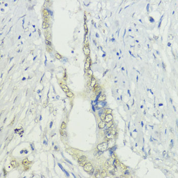 BAZ2A Rabbit Polyclonal Antibody - Image 3