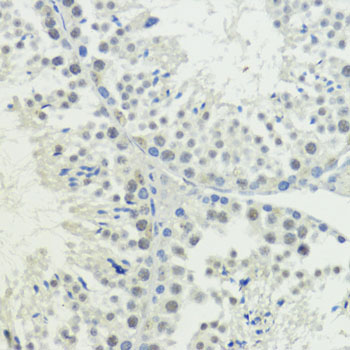 BAZ2A Rabbit Polyclonal Antibody - Image 4