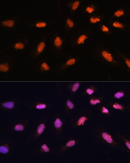 BAZ2A Rabbit Polyclonal Antibody - Image 5