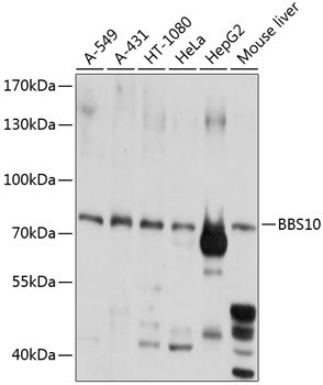 BBS10 Rabbit Polyclonal Antibody