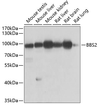 BBS2 Rabbit Polyclonal Antibody