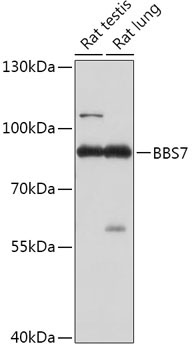 BBS7 Rabbit Polyclonal Antibody