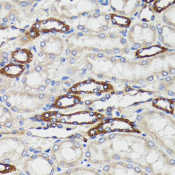 BCAP29 Rabbit Polyclonal Antibody - Image 2