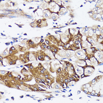 BCAP29 Rabbit Polyclonal Antibody - Image 3