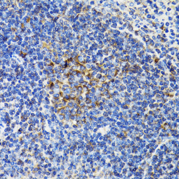 BCAP29 Rabbit Polyclonal Antibody - Image 4