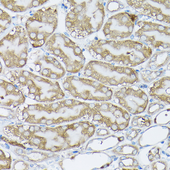 BCAR1 Rabbit Polyclonal Antibody - Image 3