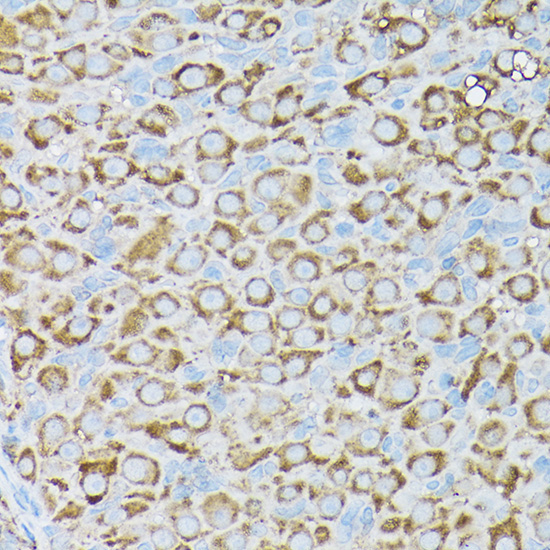 BCAR1 Rabbit Polyclonal Antibody - Image 4