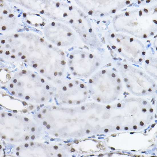 BCAS2 Rabbit Polyclonal Antibody - Image 2