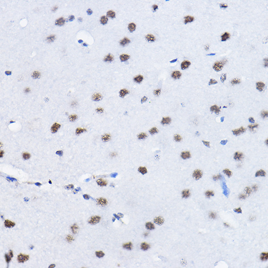 BCAS2 Rabbit Polyclonal Antibody - Image 4