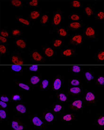 BCAS2 Rabbit Polyclonal Antibody - Image 5