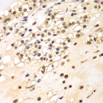 BCAS3 Rabbit Polyclonal Antibody - Image 2