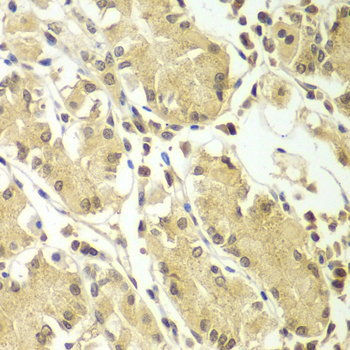 BCAS3 Rabbit Polyclonal Antibody - Image 3