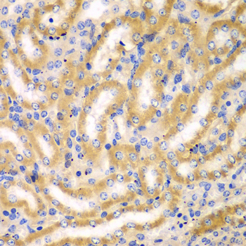 BCAS3 Rabbit Polyclonal Antibody - Image 4