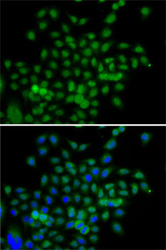BCAS3 Rabbit Polyclonal Antibody - Image 5