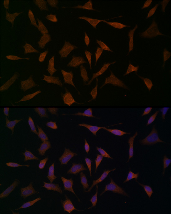 BCAT1 Rabbit Polyclonal Antibody - Image 2