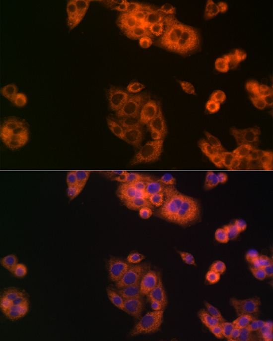 BCAT1 Rabbit Polyclonal Antibody - Image 3