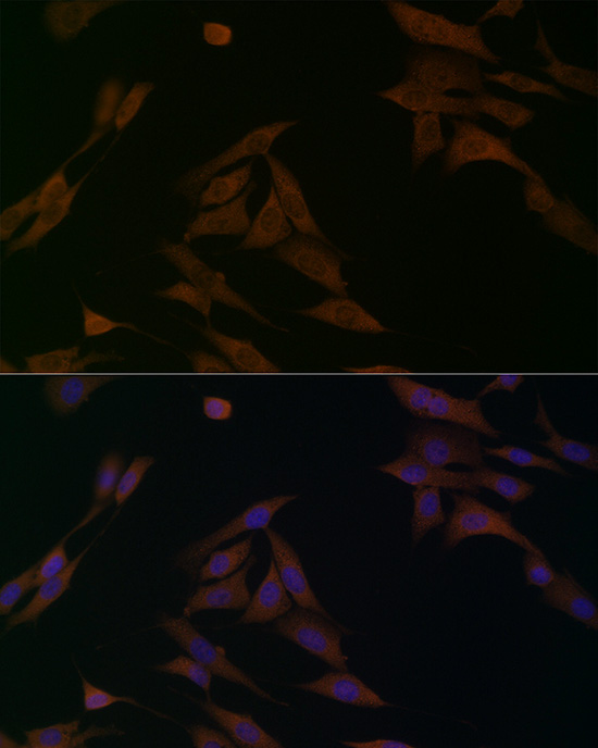 BCAT1 Rabbit Polyclonal Antibody - Image 4