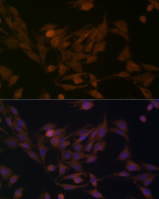 BCAT1 Rabbit Polyclonal Antibody - Image 5