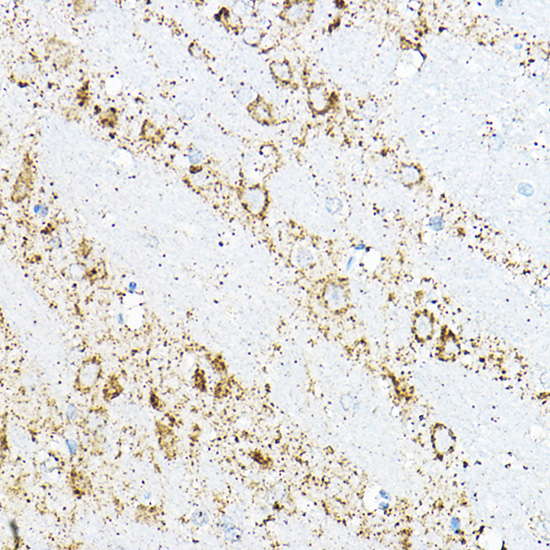 BCAT2 Rabbit Polyclonal Antibody - Image 3