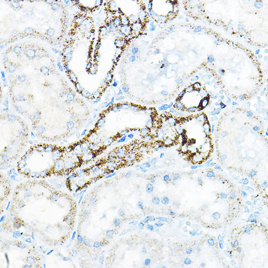 BCAT2 Rabbit Polyclonal Antibody - Image 4