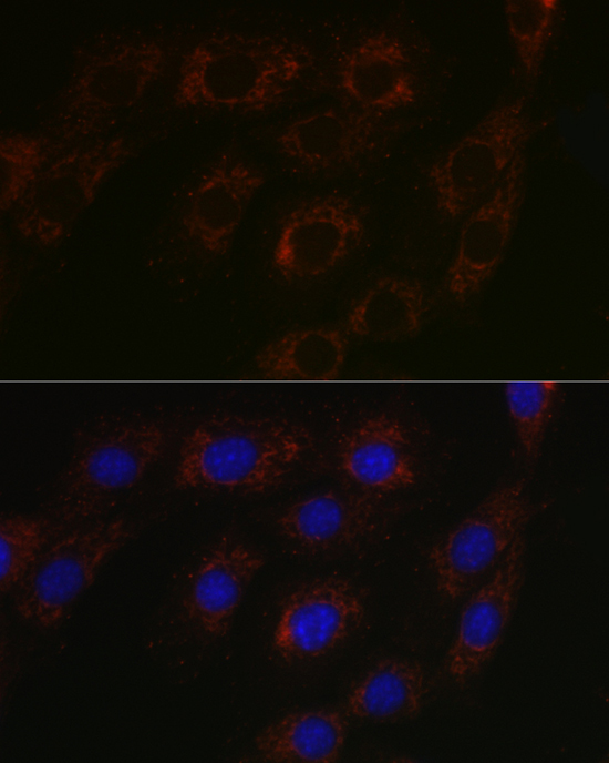 BCAT2 Rabbit Polyclonal Antibody - Image 5