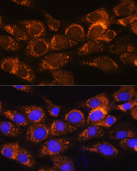 BCKDHA Rabbit Polyclonal Antibody - Image 3