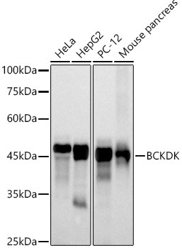 BCKDK Rabbit Monoclonal Antibody