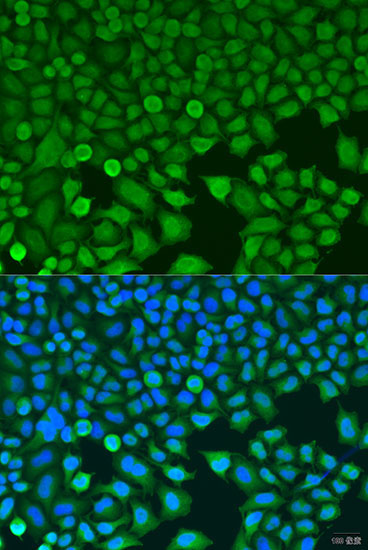 BCKDK Rabbit Polyclonal Antibody - Image 2