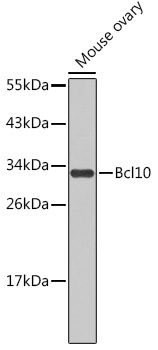 Bcl10 Rabbit Polyclonal Antibody