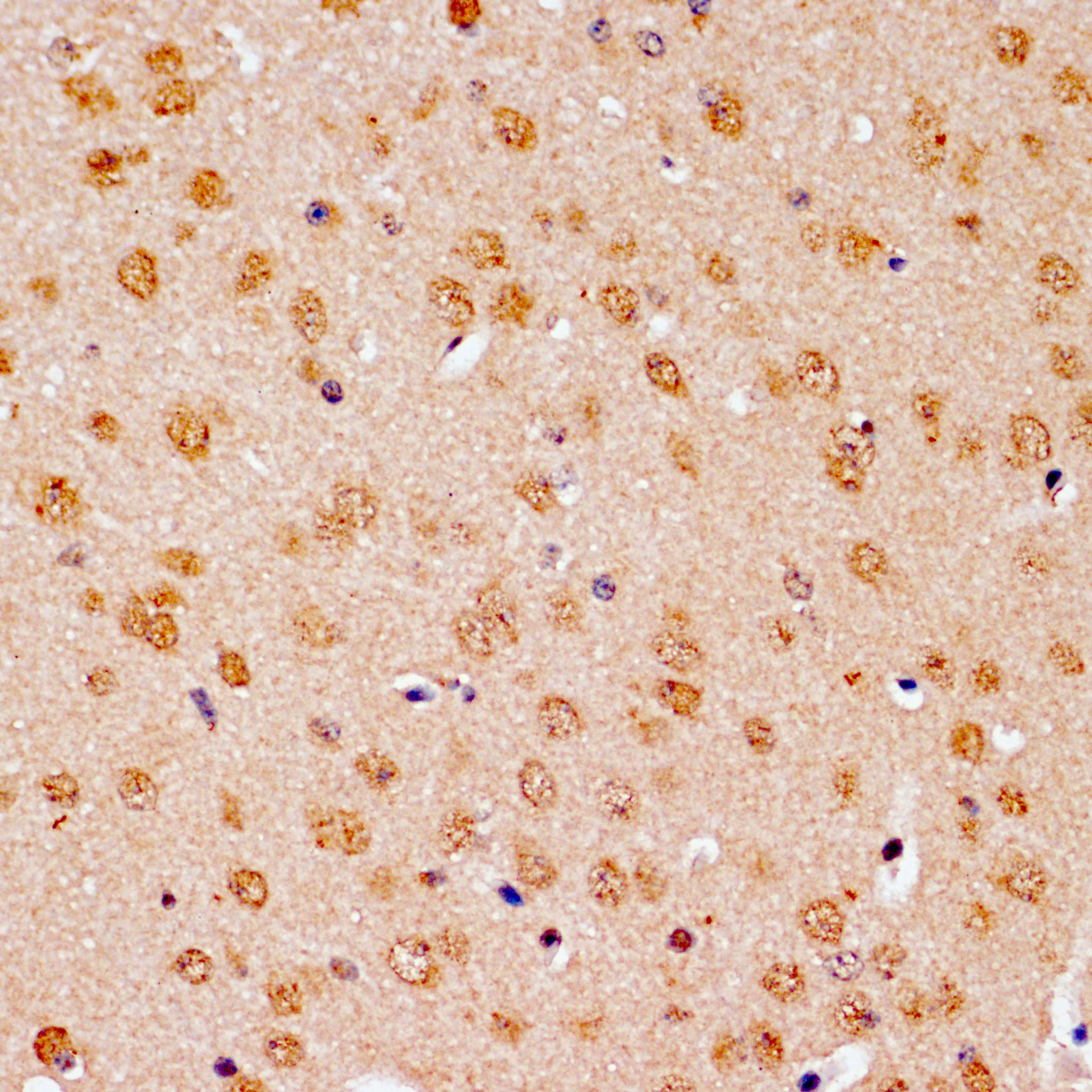 Bcl-2 Rabbit Polyclonal Antibody