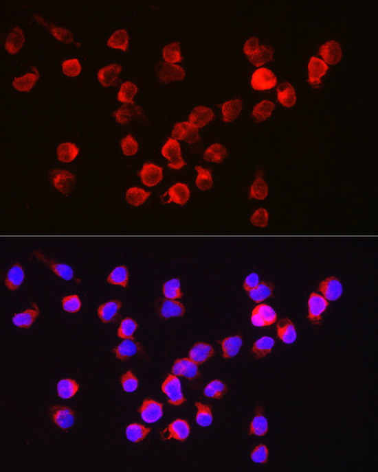 BCL2A1 Rabbit Polyclonal Antibody