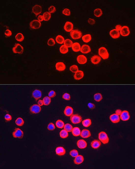 BCL2A1 Rabbit Polyclonal Antibody - Image 2